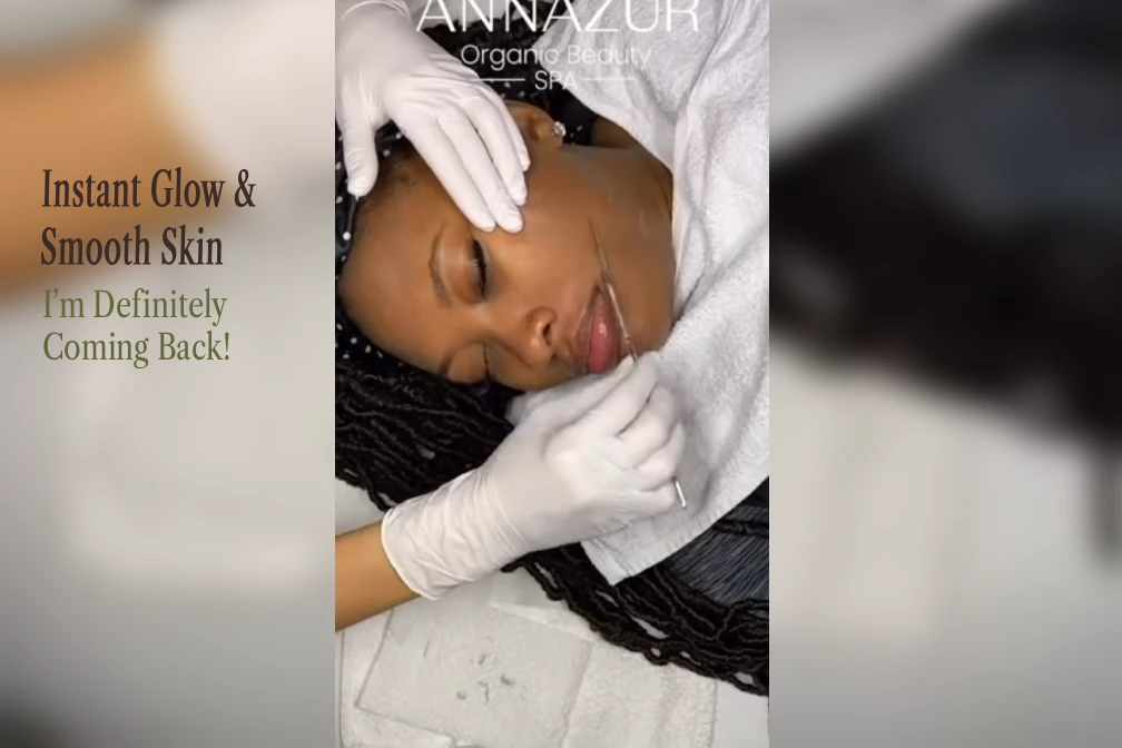 Video review from an ANNAZUR client — Dermaplaning – Jacksonville FL, Jacksonville FL