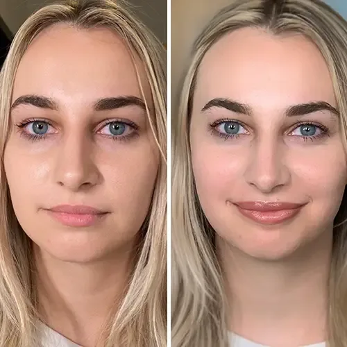 Lip Blushing result at ANNAZUR Organic Beauty Spa, Jacksonville FL — photo 6