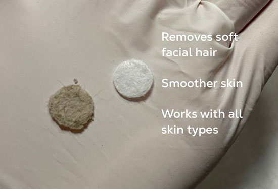 Before and after microdermabrasion in jacksonville at ANNAZUR Organic Beauty Spa, Jacksonville FL — photo 6