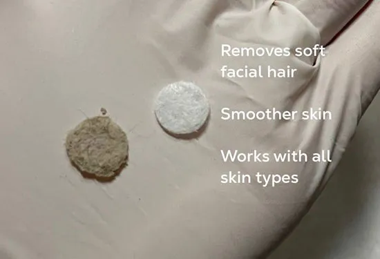 Before and after microdermabrasion in jacksonville at ANNAZUR Organic Beauty Spa, Jacksonville FL — photo 6