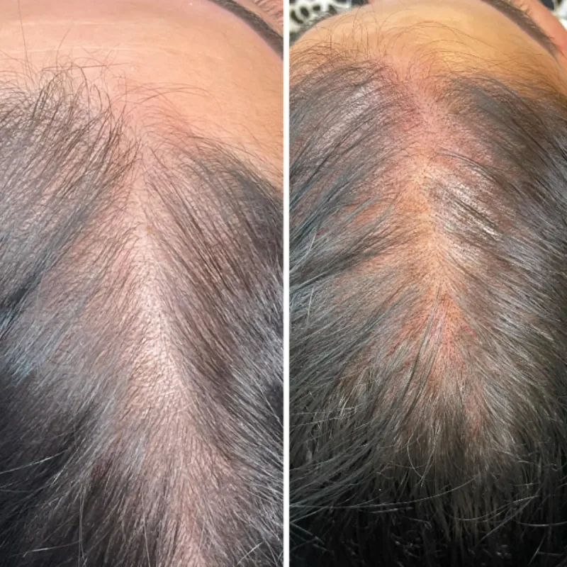 Scalp and hair before-and-after comparison