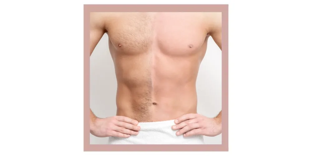 Sugar & Wax depilation – the best solution for men!