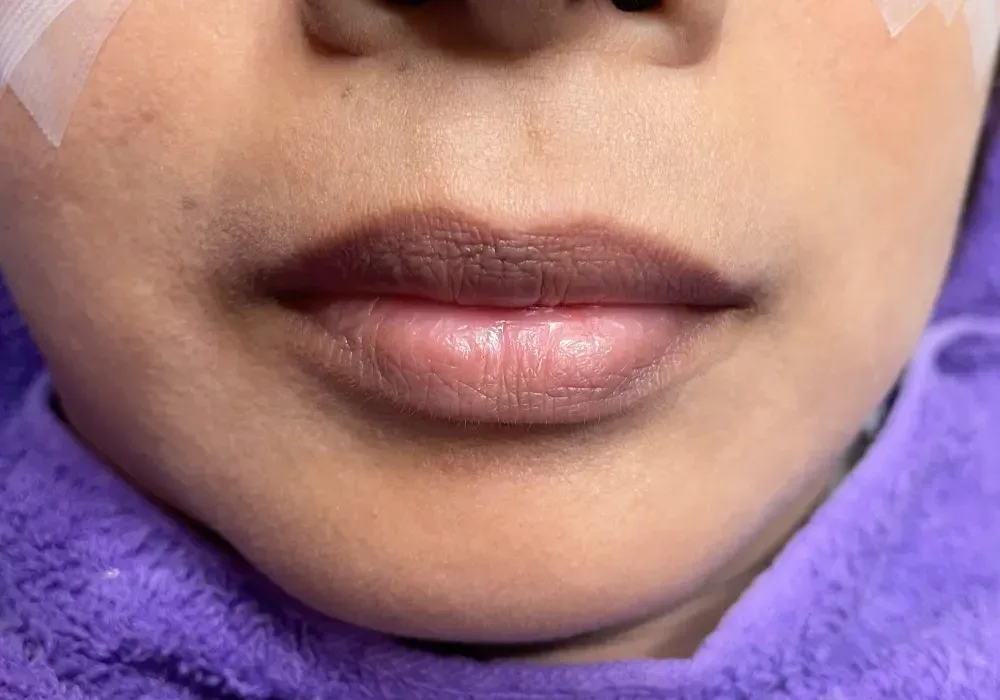 A close-up of pale, colorless lips, illustrating a client who would benefit from lip tattooing to add brightness and correct shape.