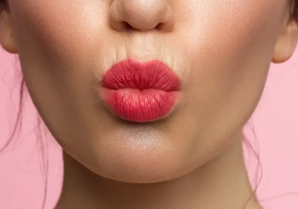 Client shows maximum lip swelling and tightness on second day after permanent makeup tattooing