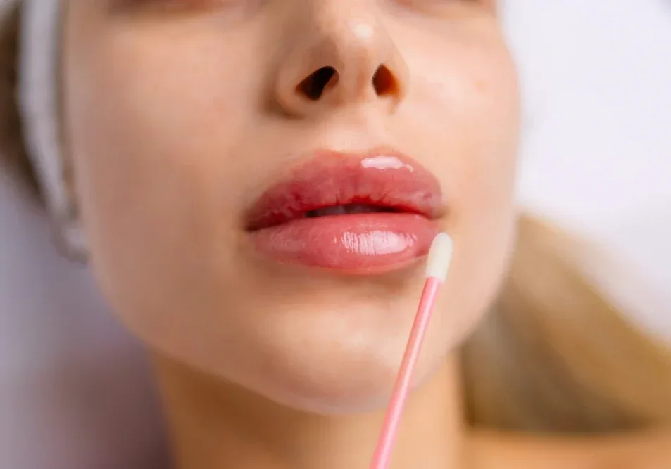A cotton swab is used on swollen lips immediately after permanent makeup.