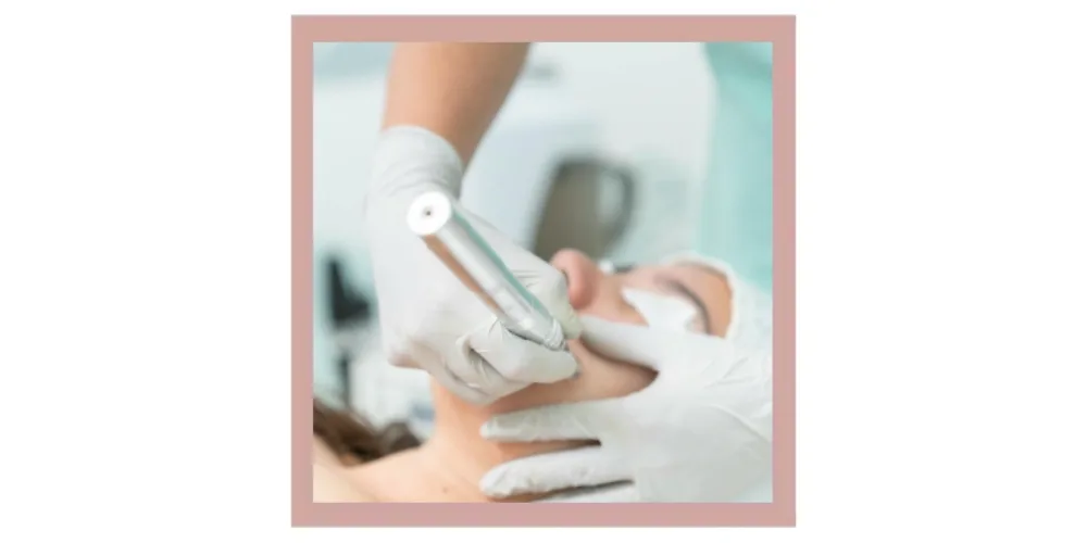 Preparing for microneedling: what do I need to know?