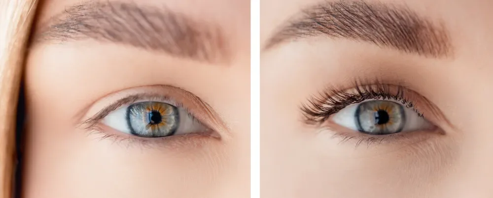 Side-by-side comparison of a subtle classic eyelash extension result.