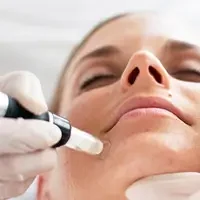 Woman getting professional microneedling facial service with specialized technique for complexion improvement