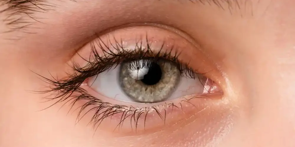 How Improper Application Damages Natural Lashes A close-up of sparse, clumpy eyelash extensions, illustrating the potential damage to natural lashes from improper application.