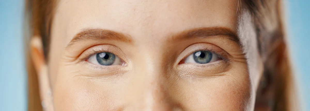 A close-up of sparse natural eyelashes, illustrating the high risk of damage like traction alopecia from DIY home kits.