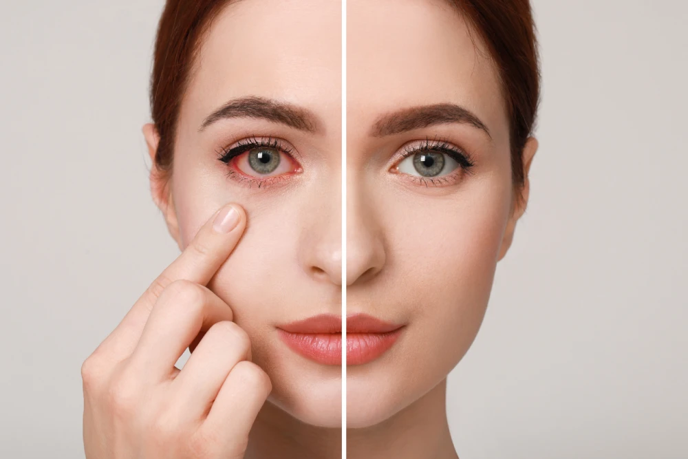 A woman touches her eye with concern, representing the safety risks associated with the chemical composition of lash lamination products, emphasizing the importance of a patch test.