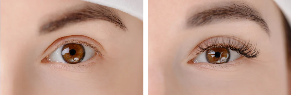 Aesthetics: Salon vs. DIY Lash Extensions A before-and-after photo showcasing the harmonious and professional look of salon eyelash extensions compared to uneven DIY results.
