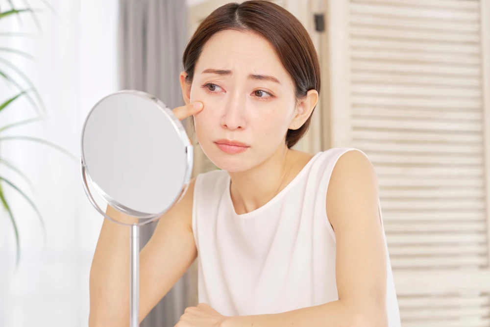 A woman inspects her red, uncomfortable eyes in a mirror, showing the symptoms of lash irritation from glue fumes.