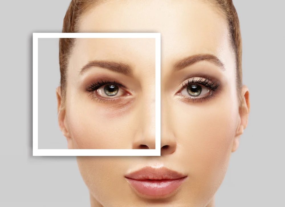 A focused view of a woman's eye, illustrating specific risks of some lash serums like eyelid skin darkening or iris color changes.