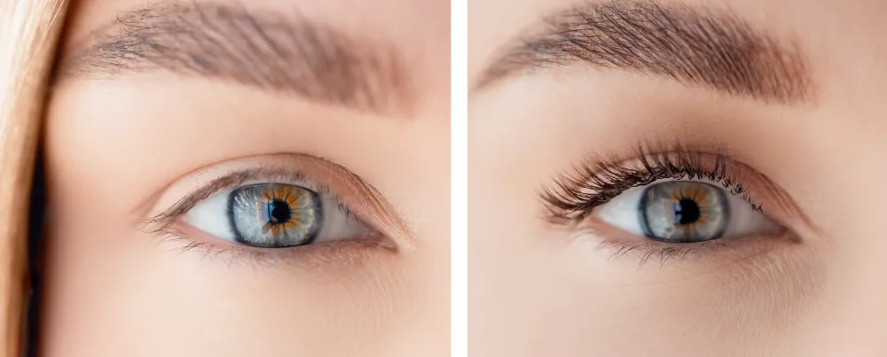 Natural Look with Classic Lash Extensions A side-by-side comparison showing how classic eyelash extensions provide a subtle yet enhanced natural look.