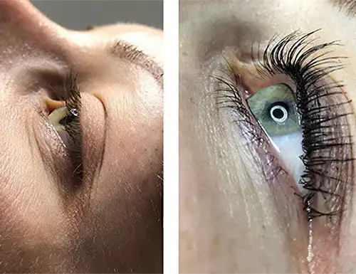 Eyelash Lift & Tint Before & After