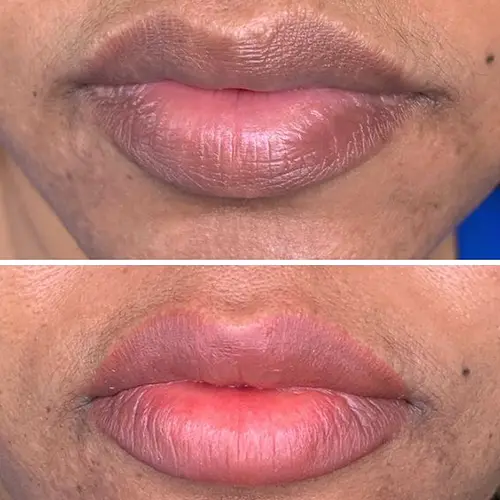 Lip Blushing Before & After