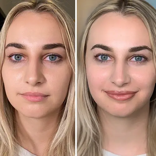 Lip Blushing Before & After