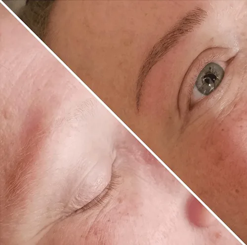 Microblading Before & After