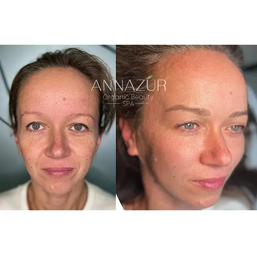 Microblading Before & After