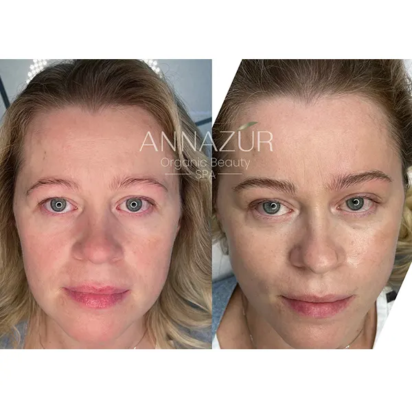 Microblading Before & After