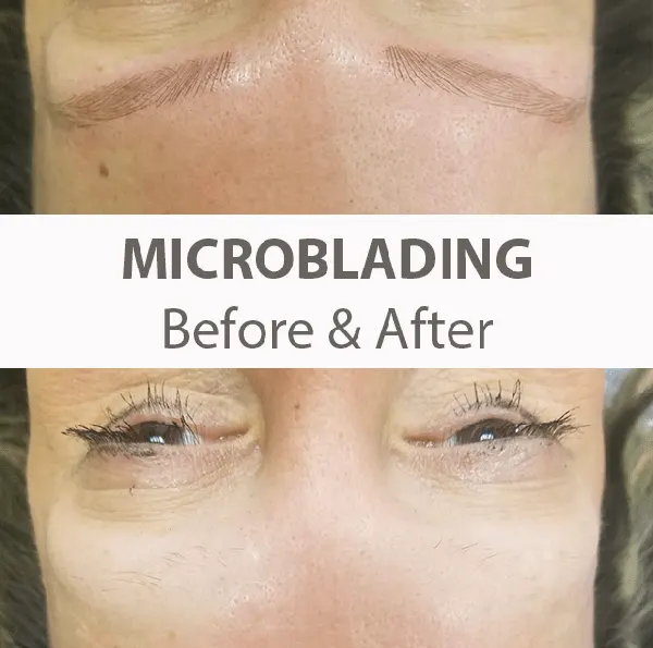 Microblading Before & After