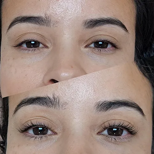 Eyelast Lift & Tint Before & After