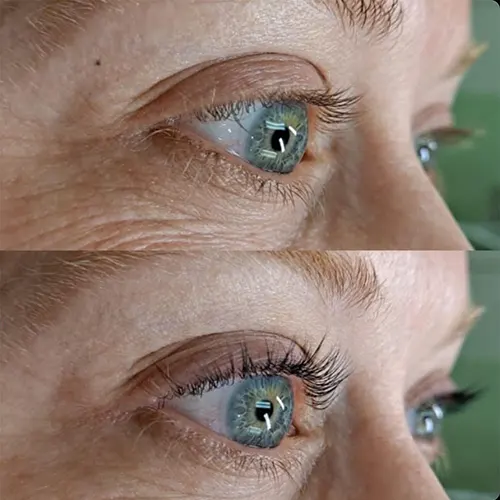 Eyelast Lift & Tint Before & After